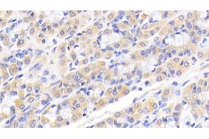 Detection of CALR in Human Stomach Tissue using Polyclonal Antibody to Calreticulin (CALR)