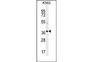 Western blot analysis using SFRP4 Antibody (C-term) Cat. (SFRP4 anticorps  (C-Term))