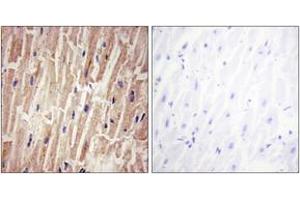 Immunohistochemistry analysis of paraffin-embedded human heart , using YAP (Phospho-Ser127) Antibody.