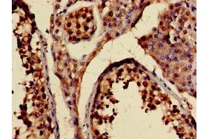 Immunohistochemistry of paraffin-embedded human testis tissue using ABIN7157612 at dilution of 1:100 (KIF2A anticorps  (AA 161-294))