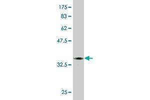 Western Blot detection against Immunogen (33. (LRIT3 anticorps  (AA 422-496))