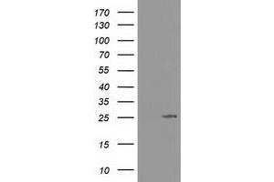 Western Blotting (WB) image for anti-Adenylate Kinase 3 (AK3) antibody (ABIN1496522) (Adenylate Kinase 3 anticorps)