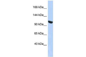 UBA1 antibody used at 1 ug/ml to detect target protein. (UBA1 anticorps  (N-Term))