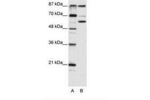 Image no. 1 for anti-K(lysine) Acetyltransferase 2B (KAT2B) (AA 190-239) antibody (ABIN202927) (KAT2B anticorps  (AA 190-239))
