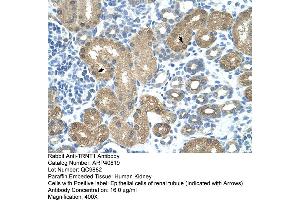 Rabbit Anti-TRNT1 Antibody  Paraffin Embedded Tissue: Human Kidney Cellular Data: Epithelial cells of renal tubule Antibody Concentration: 4. (Trnt1 anticorps  (N-Term))