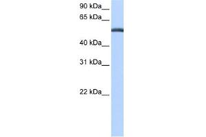 WB Suggested Anti-LACTB Antibody Titration: 0. (LACTB anticorps  (C-Term))