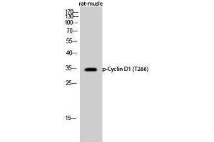Western Blotting (WB) image for anti-Cyclin D1 (CCND1) (pThr286) antibody (ABIN3172999) (Cyclin D1 anticorps  (pThr286))