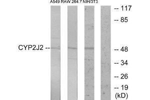 Western Blotting (WB) image for anti-Cytochrome P450, Family 2, Subfamily J, Polypeptide 2 (CYP2J2) (Internal Region) antibody (ABIN1850360)