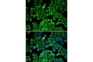 Immunofluorescence analysis of A549 cells using EIF4B antibody. (EIF4B anticorps)