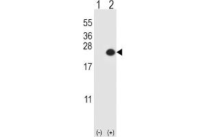 Western Blotting (WB) image for anti-Dual Specificity Phosphatase 3 (DUSP3) antibody (ABIN3003774) (Dual Specificity Phosphatase 3 (DUSP3) anticorps)