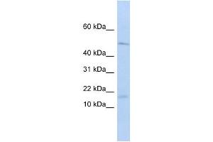 VPREB1 antibody used at 1 ug/ml to detect target protein. (VPREB1 anticorps  (Middle Region))