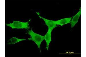 Immunofluorescence of monoclonal antibody to DCAMKL1 on NIH/3T3 cell.