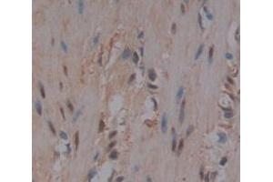 Used in DAB staining on fromalin fixed paraffin- embedded skeletal muscle tissue (FLII anticorps  (AA 896-1176))