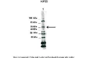 Lanes:   1. (KIF22 anticorps  (N-Term))