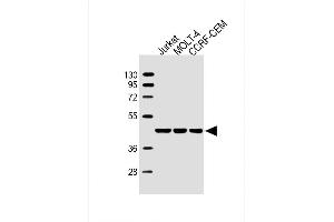 Lane 1: Jurkat, Lane 2: MOLT-4, Lane 3: CCRF-CEM cell lysate at 20 µg per lane, probed with bsm-51447M ADA (608CT2. (ADA anticorps)