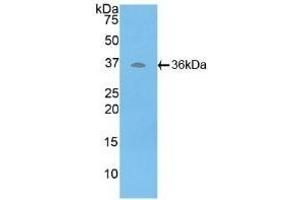 Detection of Recombinant ATP6AP2, Human using Polyclonal Antibody to ATPase, H+ Transporting, Lysosomal Accessory Protein 2 (ATP6AP2)