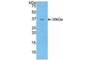 Detection of Recombinant ATP6AP2, Human using Polyclonal Antibody to ATPase, H+ Transporting, Lysosomal Accessory Protein 2 (ATP6AP2) (ATP6AP2 anticorps  (AA 17-302))