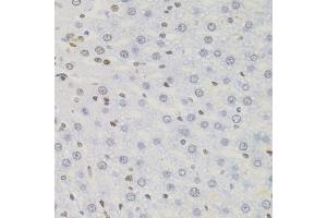 Immunohistochemistry of paraffin-embedded rat liver using AKAP8 antibody (ABIN5975842) (40x lens). (AKAP8 anticorps)