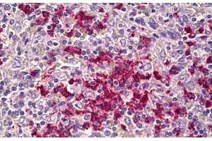 Anti-CDH23 antibody IHC staining of human spleen. (CDH23 anticorps  (AA 61-110))