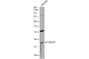 WB Image ACOT8 antibody detects ACOT8 protein by western blot analysis. (ACOT8 anticorps)