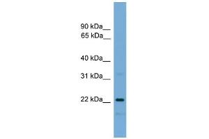 WB Suggested Anti-C9orf95 Antibody Titration: 0. (NMRK1 anticorps  (N-Term))