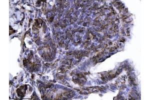 IHC analysis of Annexin-4/ANXA4 using anti-Annexin-4/ANXA4 antibody (ABIN7599265).