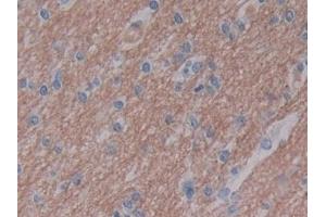 Detection of GZMB in Human Cerebrum Tissue using Polyclonal Antibody to Granzyme B (GZMB)