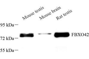 Western blot analysis of FBXO42 (ABIN7073905) at dilution of 1: 200 (FBXO42 anticorps)