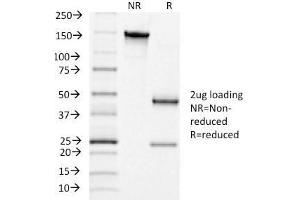 SDS-PAGE Analysis Purified LHCGR Mouse Monoclonal Antibody (LHCGR/1415). (LHCGR anticorps  (AA 70-410))