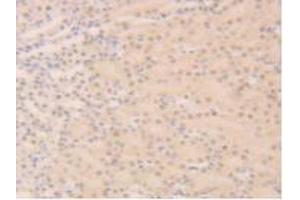Detection of SIRT6 in Mouse Kidney Tissue using Polyclonal Antibody to Sirtuin 6 (SIRT6) (SIRT6 anticorps  (AA 1-334))