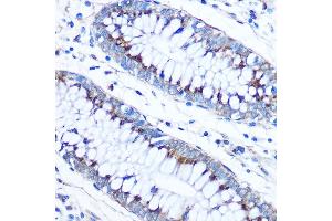 Immunohistochemistry of paraffin-embedded Human colon using FD Rabbit pAb (ABIN7267116) at dilution of 1:50 (40x lens). (FAM3D anticorps  (AA 24-204))