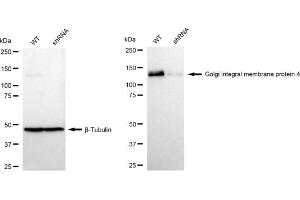 Western blotting analysis using Golgi integral membrane protein 4 antibody (ABIN7798791).