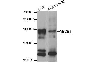 Western blot analysis of extracts of various cell lines, using ABCB1 antibody (ABIN5974625) at 1/1000 dilution. (ABCB1 anticorps)
