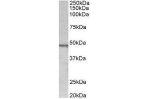 AP31711PU-N (1µg/ml) staining of Daudi lysate (35µg protein in RIPA buffer). (Chitotriosidase 1 anticorps  (Internal Region))