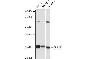 Western blot analysis of extracts of various cell lines, using CR Rabbit mAb (ABIN7266269) at 1:1000 dilution.