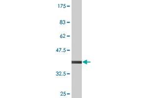 Western Blot detection against Immunogen (37.