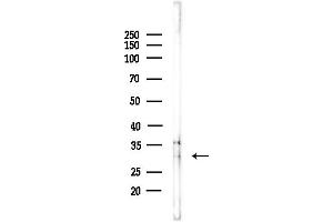 anti-Inhibitor of Growth Family, Member 2 (ING2) (C-Term) antibody