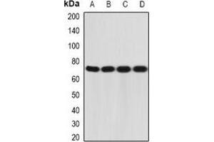 Western blot analysis of CD212 expression in A431 (A), MCF7 (B), mouse liver (C), mouse thymus (D) whole cell lysates. (IL12RB1 anticorps)
