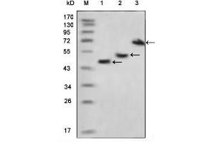 Western blot analysis using MBP mouse mAb against various fusion protein with MBP tag. (MBP Tag anticorps)