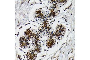 Immunohistochemistry of paraffin-embedded human breast using Ubiquitin antibody (ABIN7271129) at dilution of 1:100 (40x lens).
