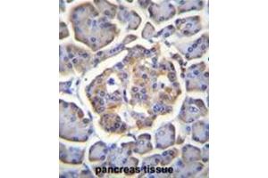 BTBD17 Antibody (C-term) immunohistochemistry analysis in formalin fixed and paraffin embedded human pancreas tissue followed by peroxidase conjugation of the secondary antibody and DAB staining.