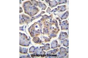 BTBD17 Antibody (C-term) immunohistochemistry analysis in formalin fixed and paraffin embedded human pancreas tissue followed by peroxidase conjugation of the secondary antibody and DAB staining. (BTBD17 anticorps  (C-Term))