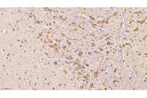 Detection of TH in Mouse Cerebrum Tissue (under 40x lens) using Polyclonal Antibody to Tyrosine Hydroxylase (TH)