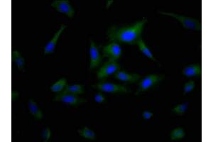 Immunofluorescence staining of Hela cells with ABIN7163899 at 1:200, counter-stained with DAPI. (POPDC3 anticorps  (AA 130-291))