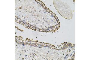 Immunohistochemistry of paraffin-embedded human prostate using ABCC3 antibody (ABIN6003581) at dilution of 1/100 (40x lens). (ABCC3 anticorps)