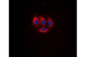 Immunofluorescent analysis of BMX (pY566) staining in HeLa cells.