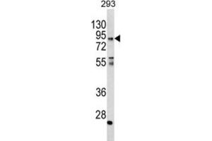 Western Blotting (WB) image for anti-Coiled-Coil alpha-Helical Rod Protein 1 (CCHCR1) antibody (ABIN3003788)