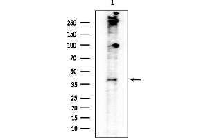 anti-Lipase, Gastric (LIPF) (N-Term) antibody