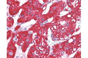 Anti-ACVR1 antibody IHC of human adrenal.