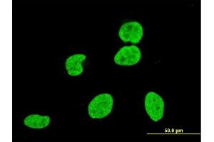 Immunofluorescence of monoclonal antibody to VPS8 on HeLa cell. (VPS8 anticorps  (AA 1329-1428))